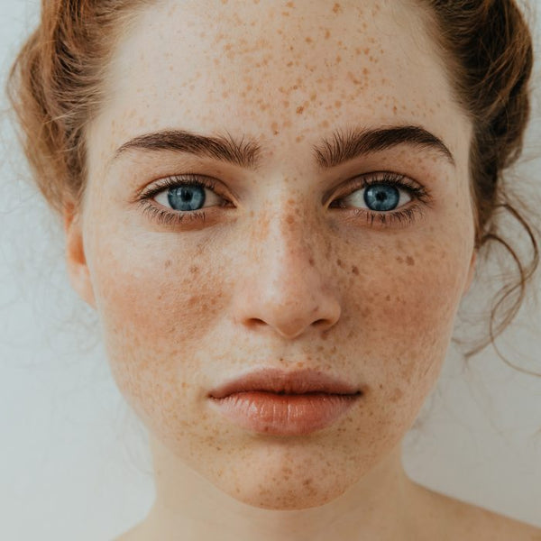 Does Oily Skin Still Need A Moisturiser?
